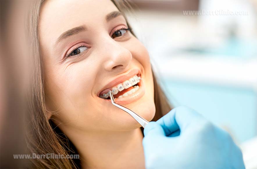 مشکلات قابل حل با ارتودنسی - orthodontic problems