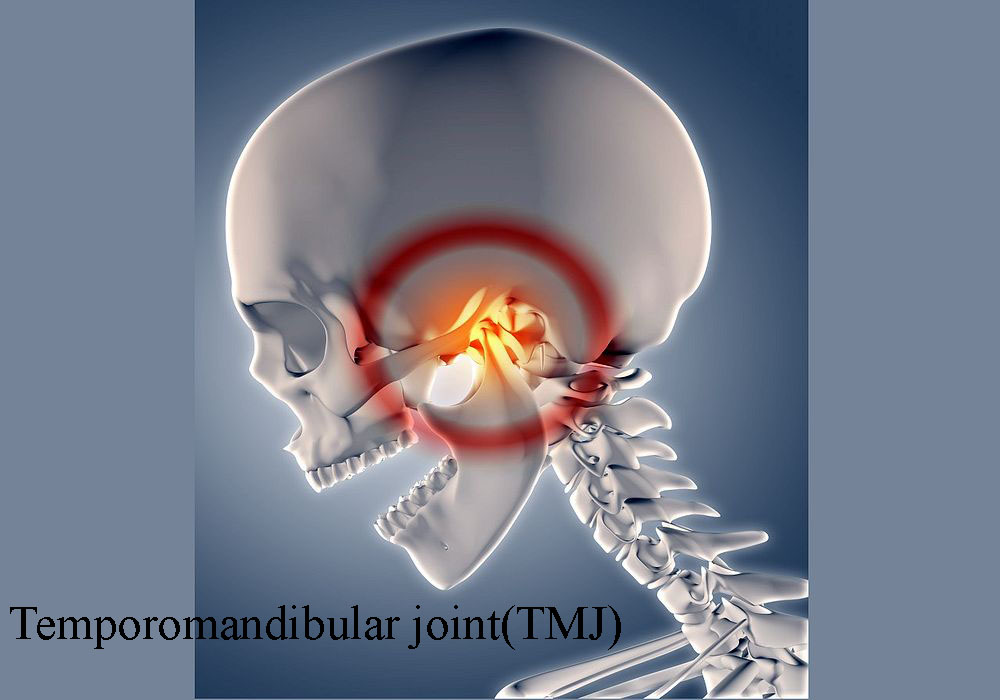  (TMJ) temporomandibular joint problems