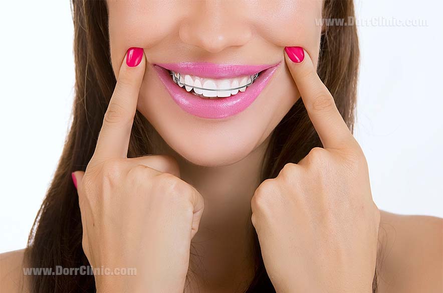 Functional Orthodontics Functional Orthodontics