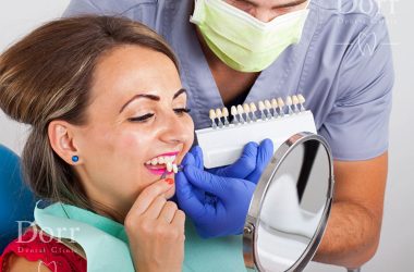 Dental veneer procedure