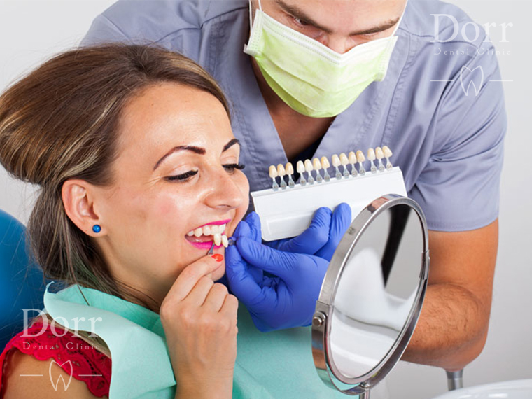 Dental veneer procedure