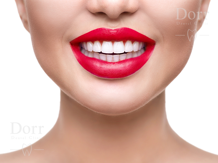 right candidate for dental veneers